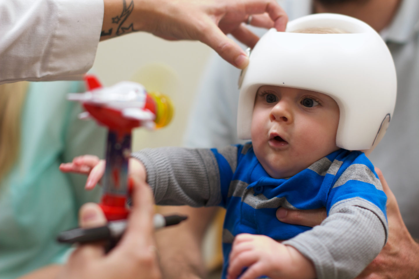 Kids cranial remolding