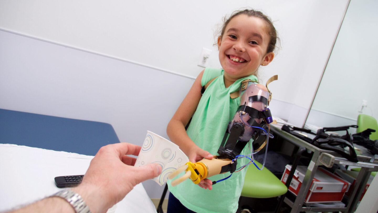 Young patient practicing with a custom prosthetic arm designed for grip and functional improvement during therapy.