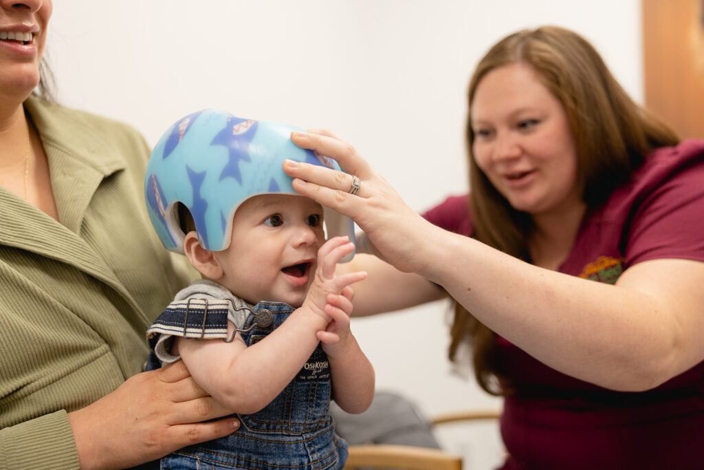 An orthotist placing a cranial remolding helmet on a pediatric patient