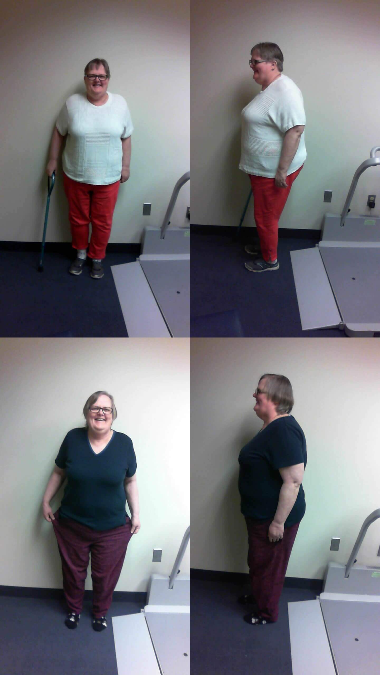 Weight Loss Success Stories Mary Free Bed 2