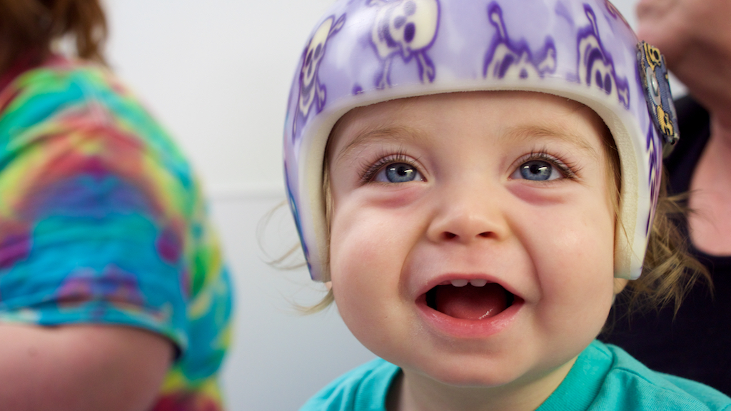 Cranial Helmet, premature babies