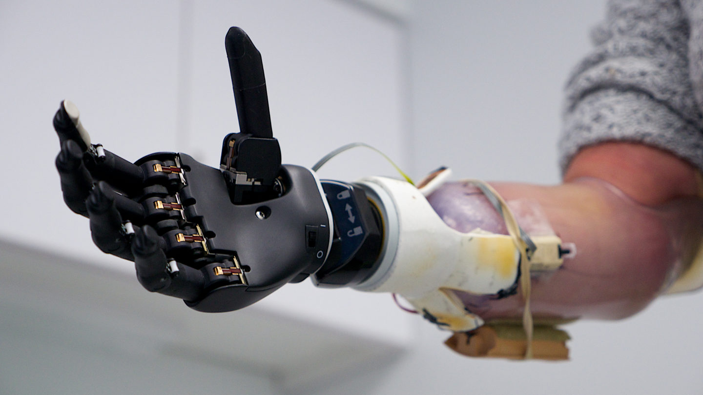 Bionic hand